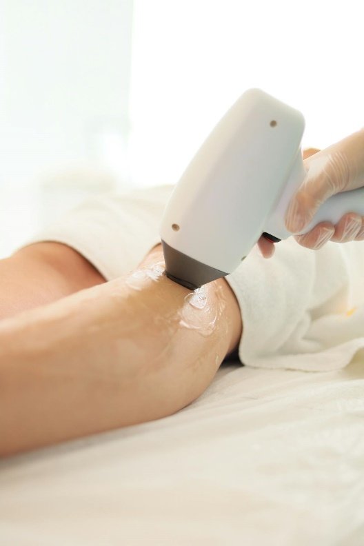 The Science Behind Laser Hair Removal: How It Works and What to Expect